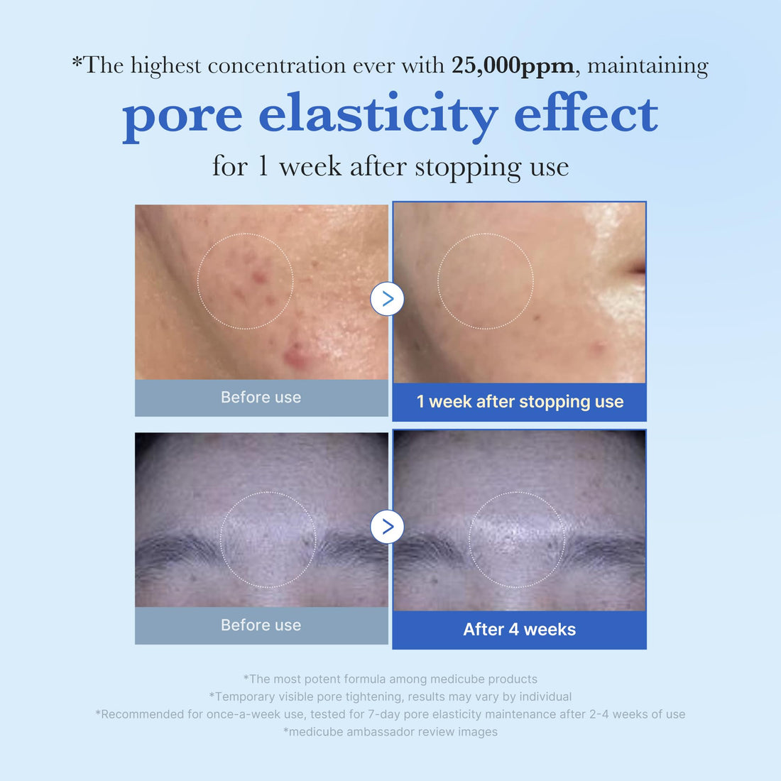 medicube Exosome Shot 25000ppm Serum for Skin Firmness and Texture