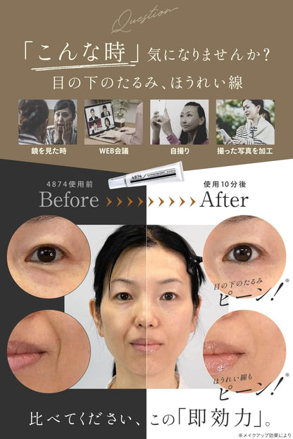 Shiwanashi Wrinkle Cream with Niacinamide for Under Eye and Mouth Areas