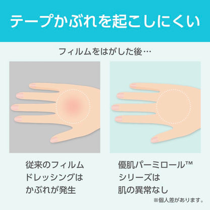 Nitoms Permiroll Lite Waterproof Film 15cm x 12m for Gentle Skin Care