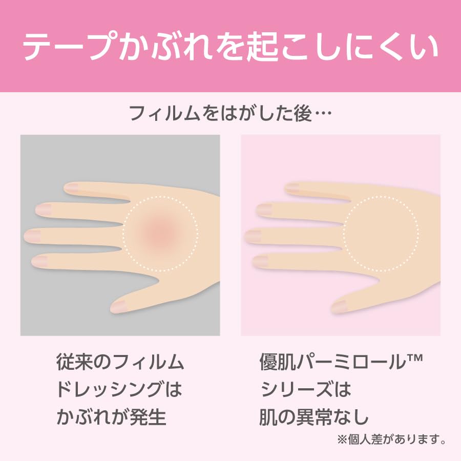 Nitoms Permiroll Waterproof Film 10cm x 10m for Gentle Skin Protection