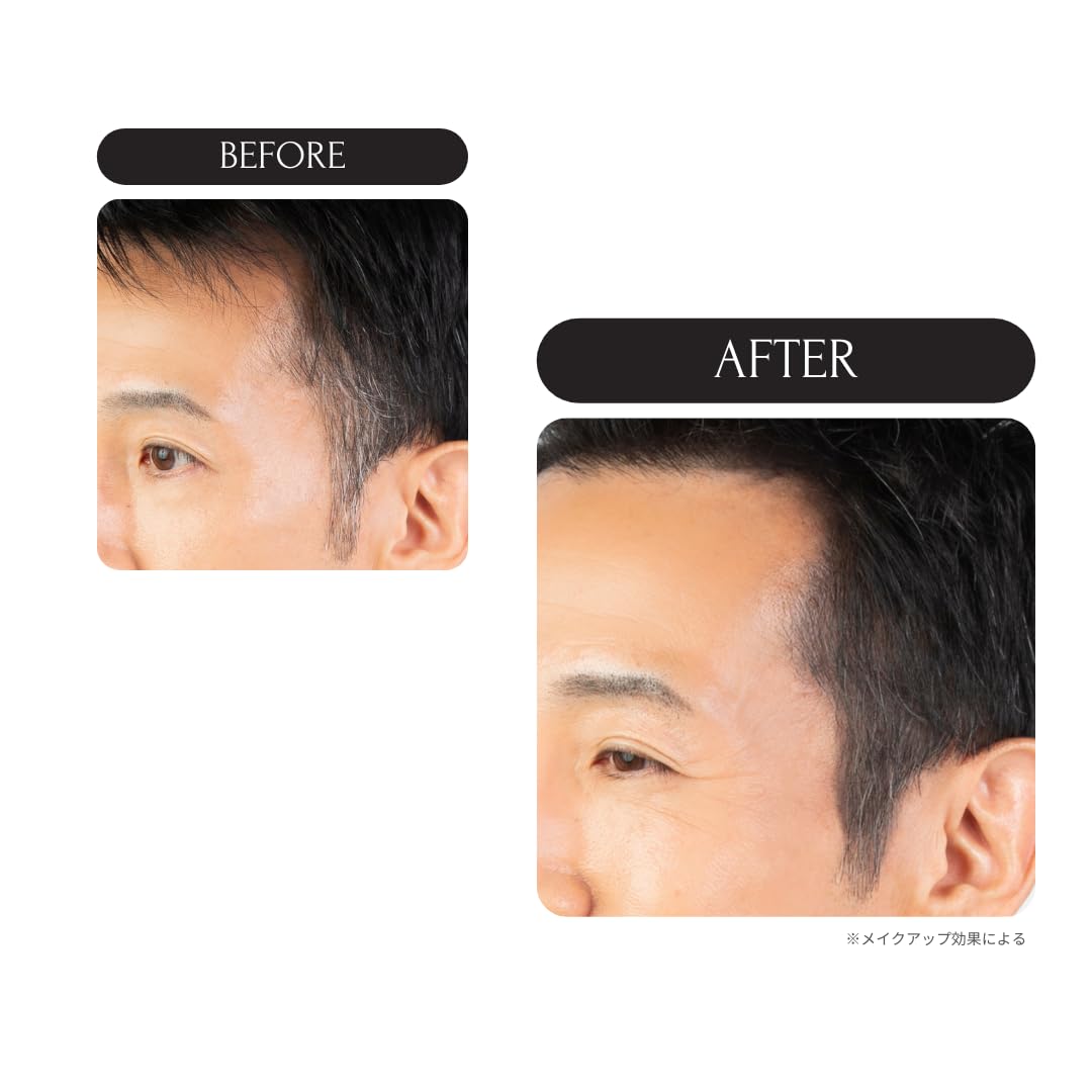 Super Million Hair Men&