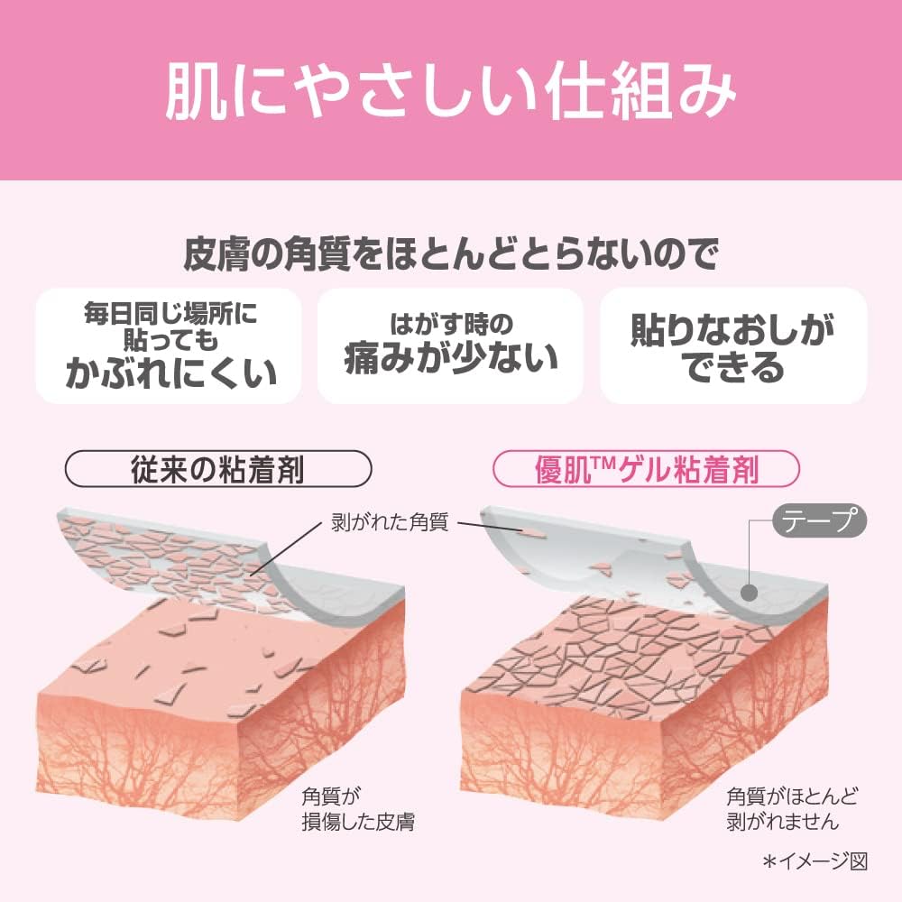 Nitoms Skin-Friendly Waterproof Film 5cm x 10m for Gentle Care