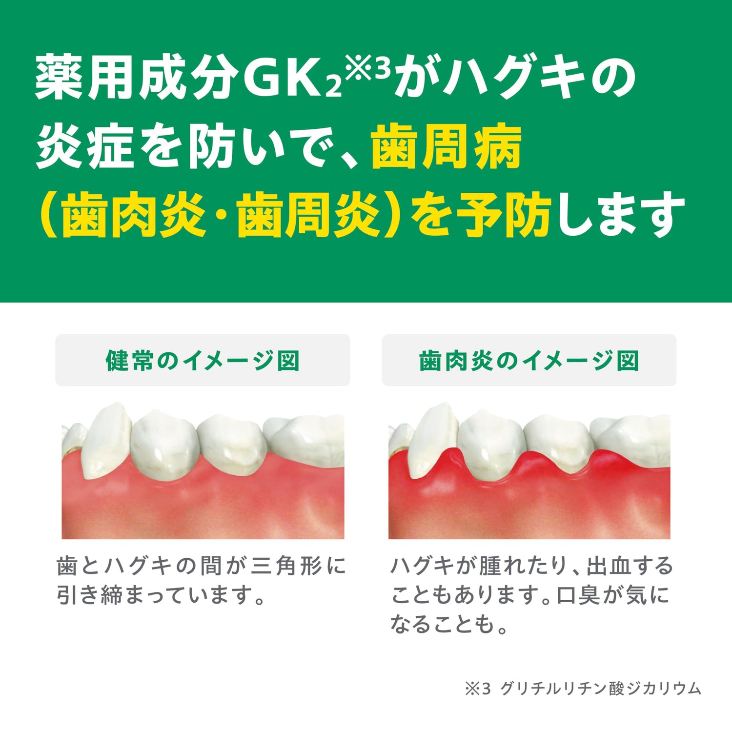 GUM Dental Paste 155g for Daily Oral Care