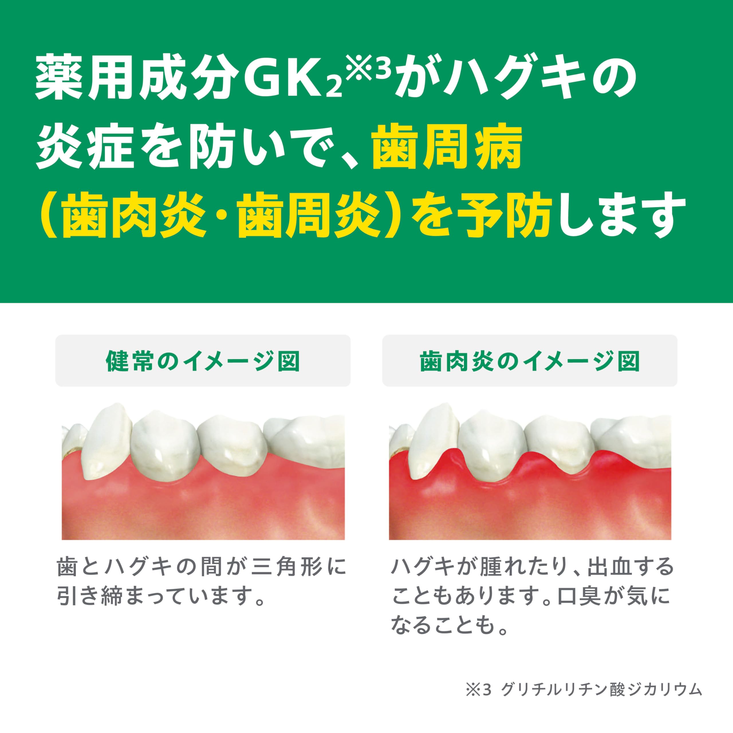 GUM Dental Paste 155g for Daily Oral Care