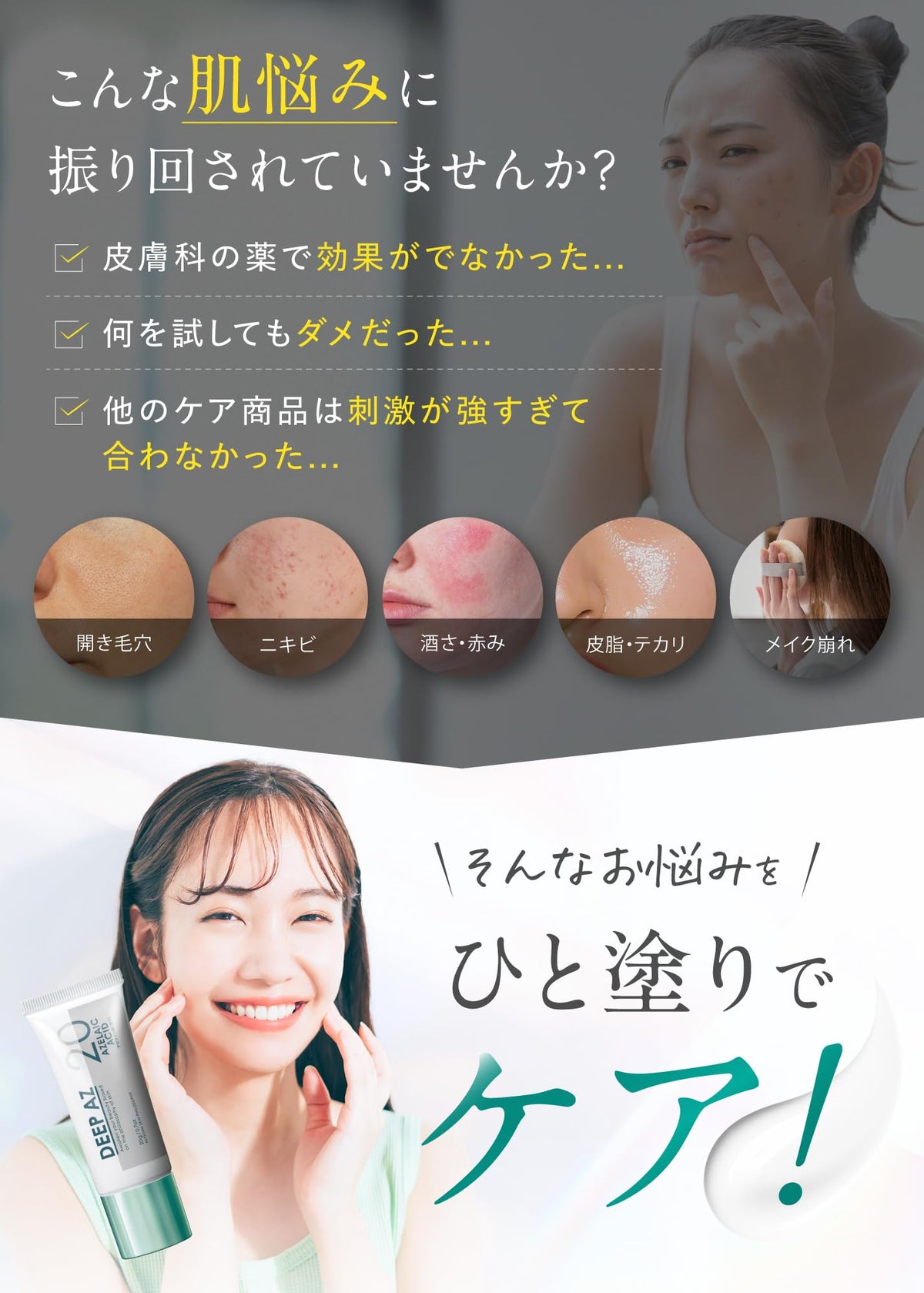 ALYSSUM SKIN PHILOSOPHY Azelaic Acid Cream 20% for Pores 2-Pack