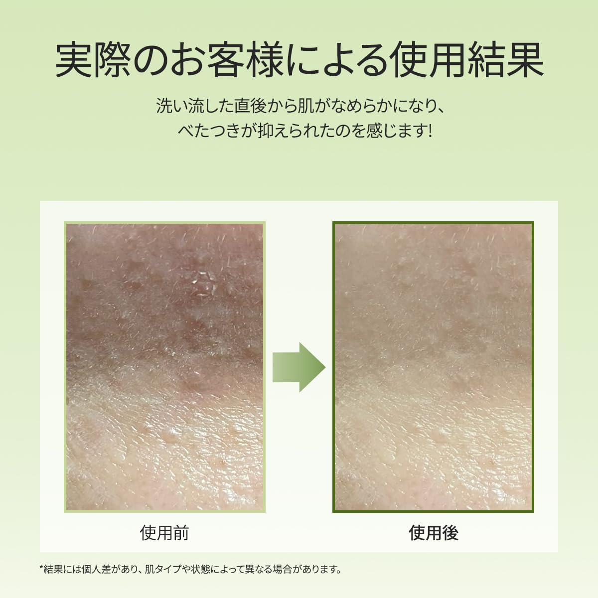 Arencia Premium Moti Soap Green 120g for Japanese Skincare