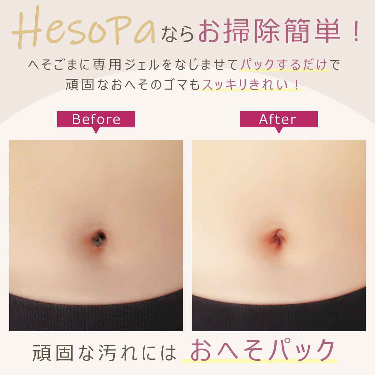 HesoPa Natural Oil Cleaner for Belly Button Care 20ml