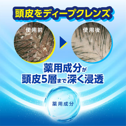h&amp;s Citrus Oil Control Shampoo Pump 330g for Japanese Hair Care