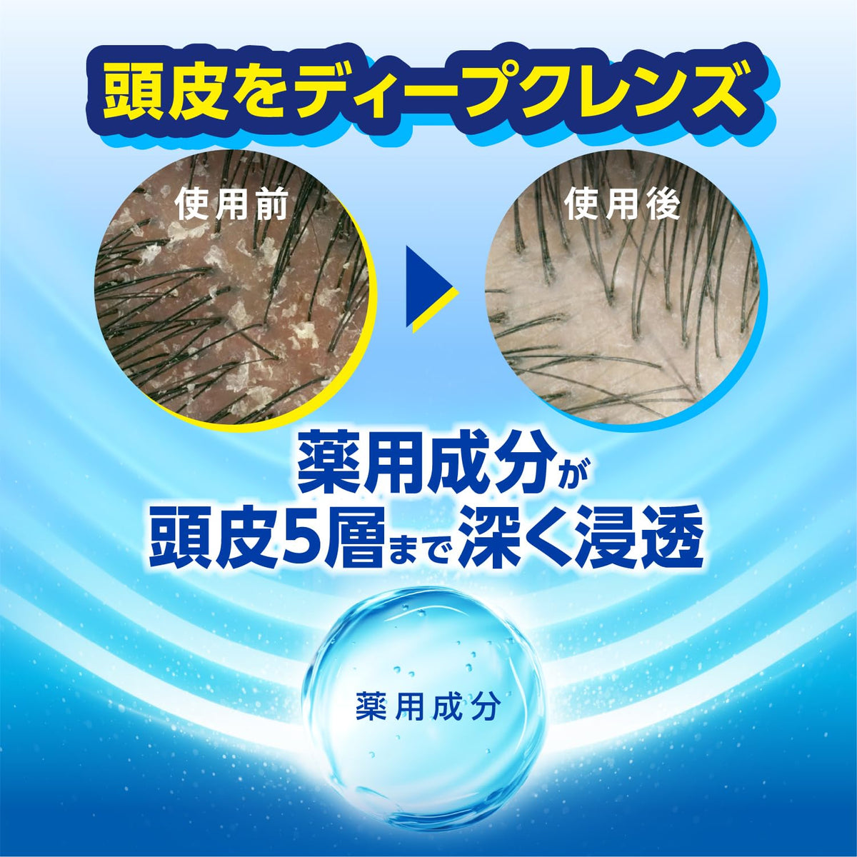 h&amp;s Moisture Conditioner Pump 340g for Japanese Hair Care
