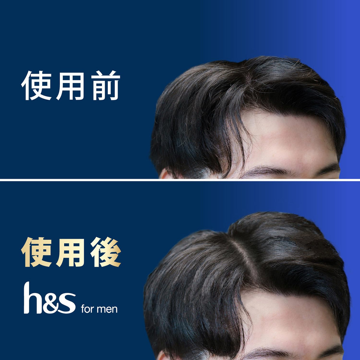 h&amp;s for men Volume Up Shampoo 350ml for Japanese Hair Care