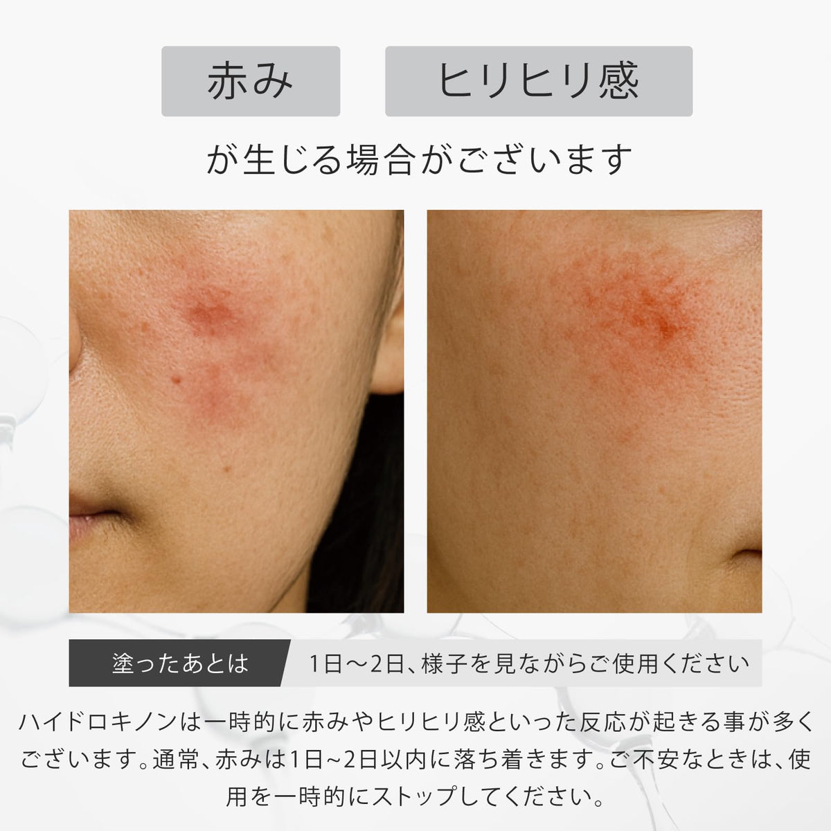 idio Hydroquinone Cream 6.0% with Ceramide and Retinol 20g