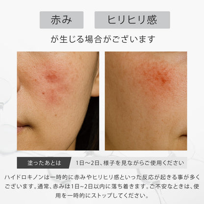 idio Hydroquinone Cream 6.0% with Ceramide and Retinol 20g