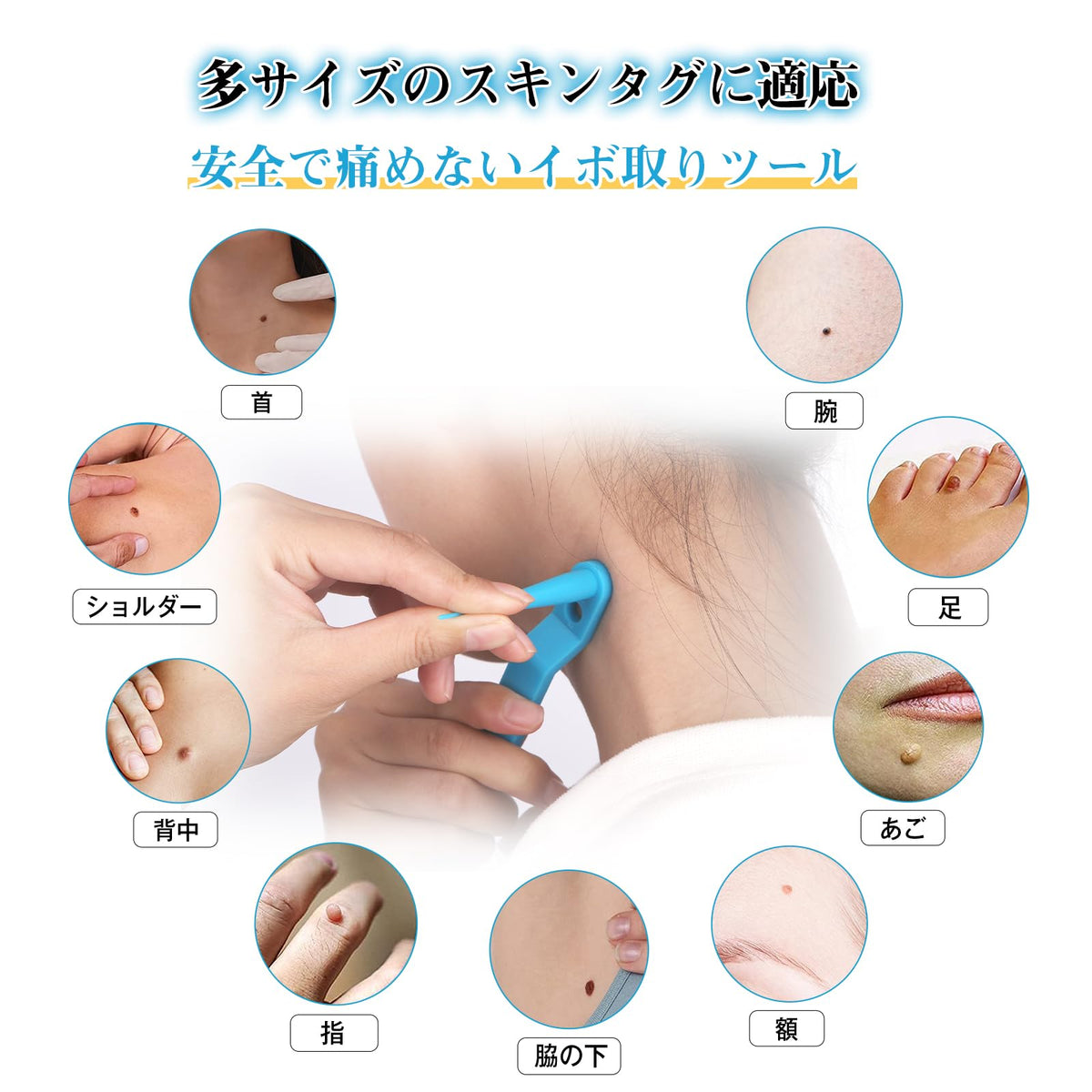 Inzyla Skin Tag Removal Tool Kit with 4 Sizes for Easy Use
