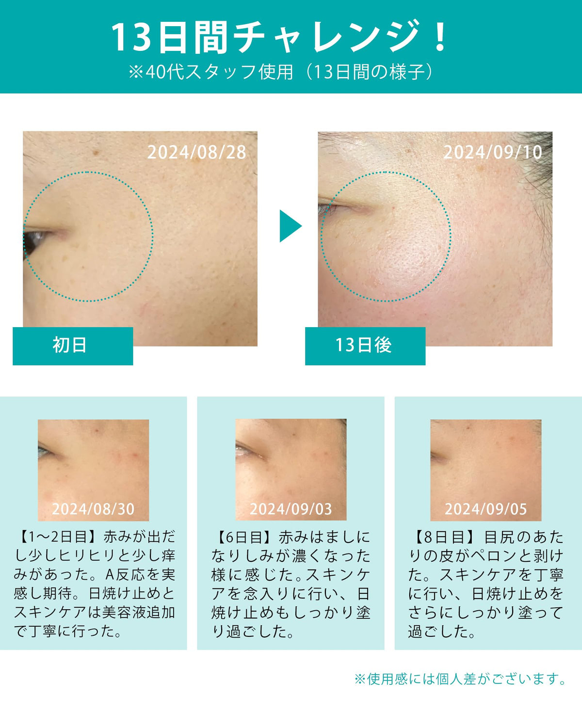 MARK AID Hydroquinone Cream for Brightening 15g