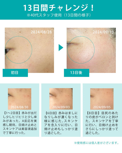 MARK AID Hydroquinone Cream for Brightening 15g