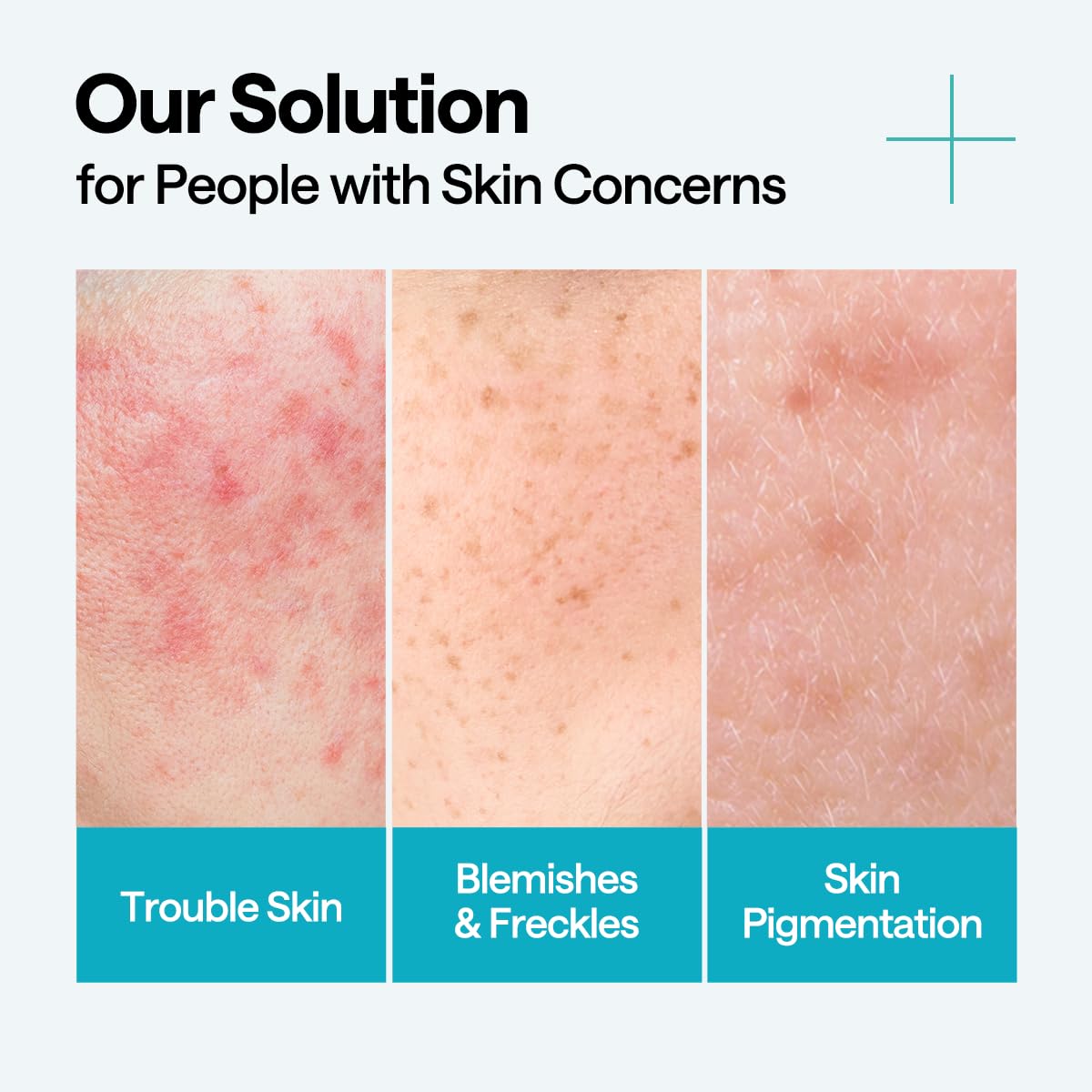 MEDIHEAL Madecassoside Blemish Repair Serum 40ml for Japanese Skincare