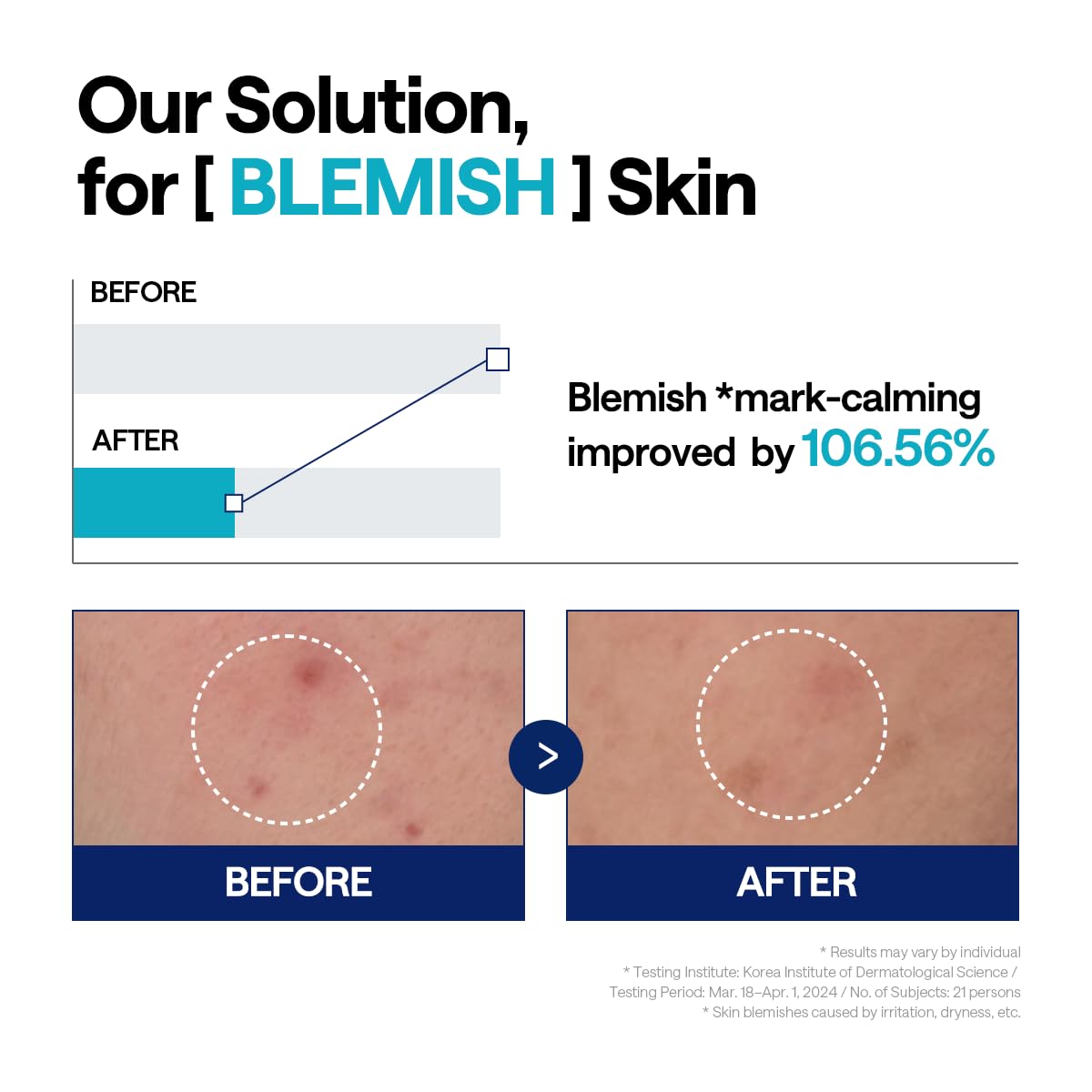 MEDIHEAL Madecassoside Blemish Repair Serum 40ml for Japanese Skincare