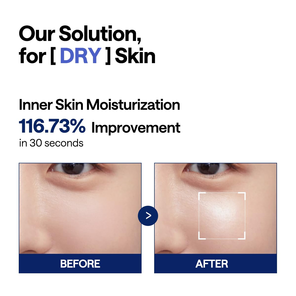 MEDIHEAL Square Toner Pads Hydrating 100 Pads 170ml