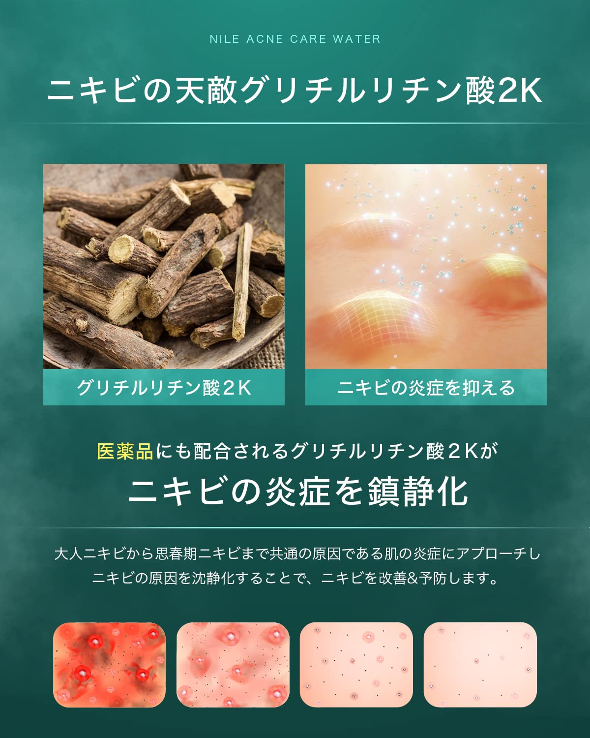 Nile Visible Spots Toner with Eucalyptus Mint 150ml for Japanese Skincare