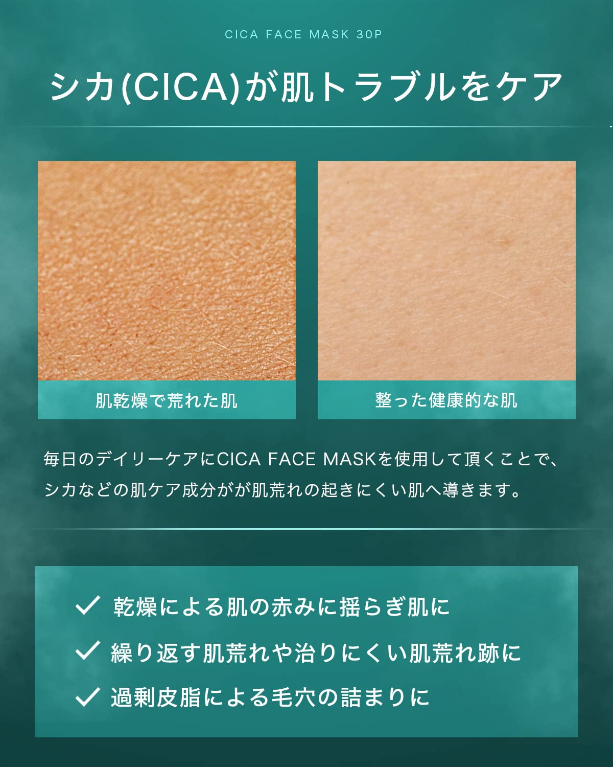 Nile Cica Face Pack for Skin Trouble Care 30 Sheets