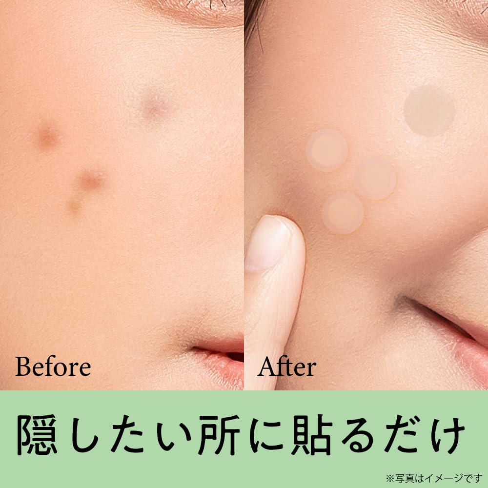 OTOKOKAKUMEI CICA Clear Patch 36 Count Hydrocolloid Spot Treatment