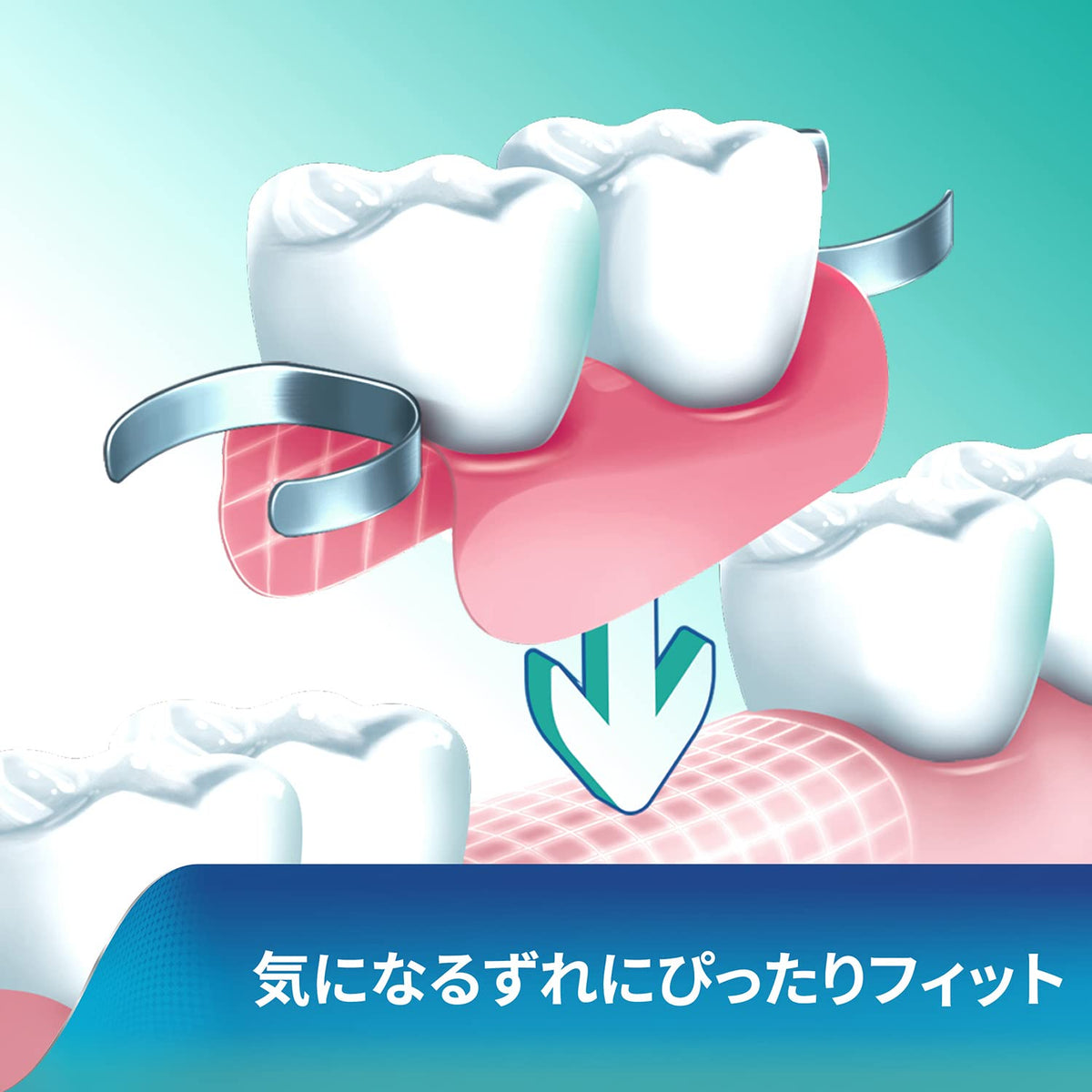 Porigurippu Denture Adhesive Cream 75g with Bonus 8.5g Gift