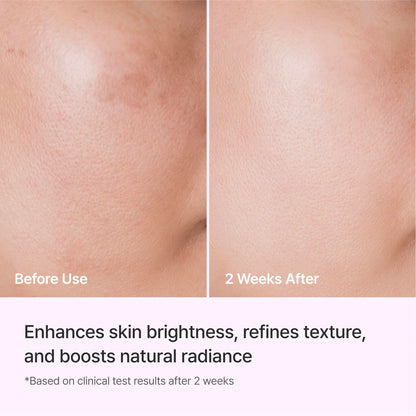 REJURAN Triple Radiance Ampoule 50ml with c-PDRN Technology