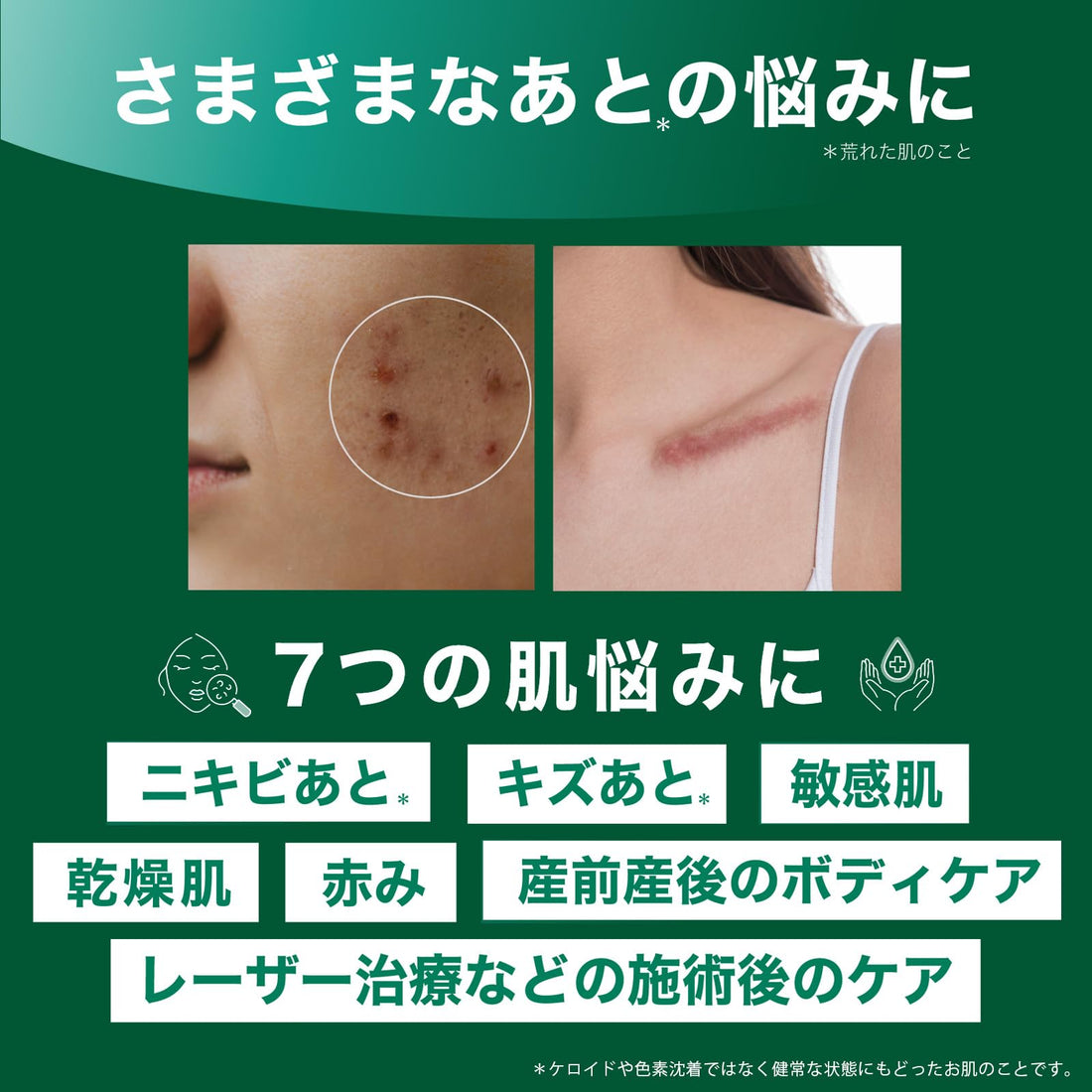 Smooth E Cream 100g - Hydrating Japanese Skincare Moisturizer