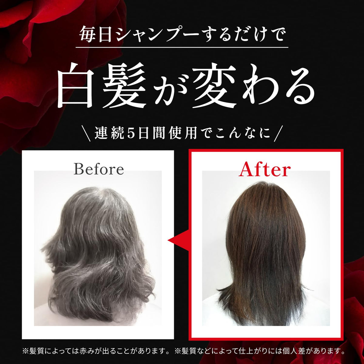 VALANROSE Color Treatment Shampoo Dark Brown 400g for Hair Care